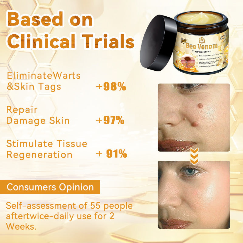 ThinkFlye™ Bee Venom Skin Treatment Cream(𝐴𝐴𝐷 𝑅𝑒𝑐𝑜𝑚𝑚𝑒𝑛𝑑𝑒𝑑)