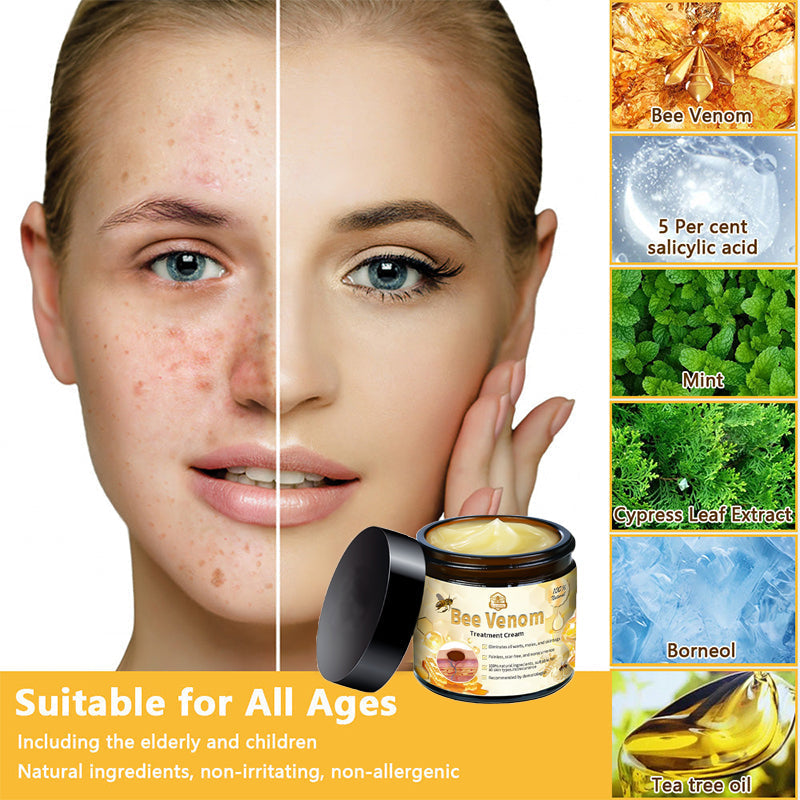 ThinkFlye™ Bee Venom Skin Treatment Cream（𝐴𝐴𝐷 𝑅𝑒𝑐𝑜𝑚𝑚𝑒𝑛𝑑𝑒𝑑）