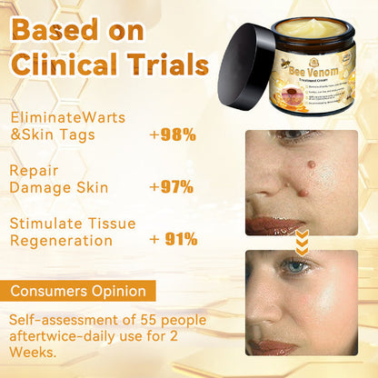 ThinkFlye™ Bee Venom Skin Treatment Cream（𝐴𝐴𝐷 𝑅𝑒𝑐𝑜𝑚𝑚𝑒𝑛𝑑𝑒𝑑）
